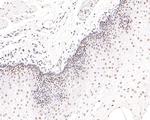 NUP50 Antibody in Immunohistochemistry (Paraffin) (IHC (P))