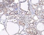 NUP50 Antibody in Immunohistochemistry (Paraffin) (IHC (P))