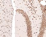 NUP50 Antibody in Immunohistochemistry (Paraffin) (IHC (P))