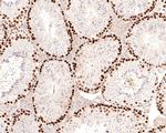 Phospho-MCM2 (Ser108) Antibody in Immunohistochemistry (Paraffin) (IHC (P))