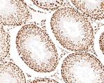 AKAP8 Antibody in Immunohistochemistry (Paraffin) (IHC (P))