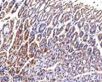 CLPX Antibody in Immunohistochemistry (Paraffin) (IHC (P))