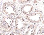 CLPX Antibody in Immunohistochemistry (Paraffin) (IHC (P))