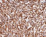 NDUFB9 Antibody in Immunohistochemistry (Paraffin) (IHC (P))