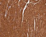 NDUFB9 Antibody in Immunohistochemistry (Paraffin) (IHC (P))