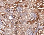 NDUFB9 Antibody in Immunohistochemistry (Paraffin) (IHC (P))