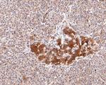 GRSF1 Antibody in Immunohistochemistry (Paraffin) (IHC (P))