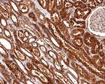 RAB5C Antibody in Immunohistochemistry (Paraffin) (IHC (P))