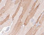 ATG4A Antibody in Immunohistochemistry (Paraffin) (IHC (P))