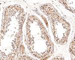 ATG4A Antibody in Immunohistochemistry (Paraffin) (IHC (P))