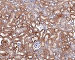 ATG4A Antibody in Immunohistochemistry (Paraffin) (IHC (P))