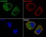 ALS2CR1 Antibody in Immunocytochemistry (ICC/IF)