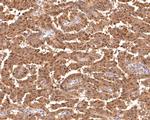 ALS2CR1 Antibody in Immunohistochemistry (Paraffin) (IHC (P))