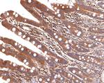 ALDH16A1 Antibody in Immunohistochemistry (Paraffin) (IHC (P))