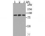 ALDH16A1 Antibody in Western Blot (WB)