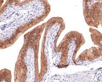 PKN2 Antibody in Immunohistochemistry (Paraffin) (IHC (P))