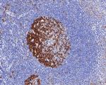 NCAPD2 Antibody in Immunohistochemistry (Paraffin) (IHC (P))