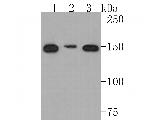 NCAPD2 Antibody in Western Blot (WB)