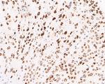 RPL13 Antibody in Immunohistochemistry (Paraffin) (IHC (P))