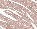 alpha-1a Adrenergic Receptor Antibody in Immunohistochemistry (Paraffin) (IHC (P))