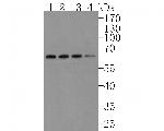 alpha-1a Adrenergic Receptor Antibody in Western Blot (WB)