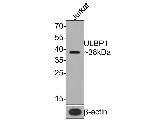 ULBP1 Antibody in Western Blot (WB)