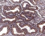 NDUFAB1 Antibody in Immunohistochemistry (Paraffin) (IHC (P))