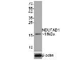 NDUFAB1 Antibody in Western Blot (WB)