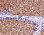 ALDH7A1 Antibody in Immunohistochemistry (Paraffin) (IHC (P))