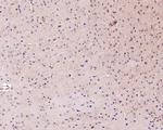 ALDH7A1 Antibody in Immunohistochemistry (Paraffin) (IHC (P))