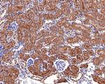 ALDH7A1 Antibody in Immunohistochemistry (Paraffin) (IHC (P))