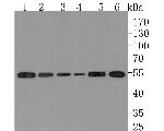 ALDH7A1 Antibody in Western Blot (WB)