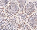 EDG2 Antibody in Immunohistochemistry (Paraffin) (IHC (P))