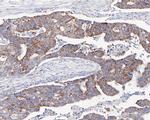 C1QBP Antibody in Immunohistochemistry (Paraffin) (IHC (P))