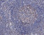 C1QBP Antibody in Immunohistochemistry (Paraffin) (IHC (P))