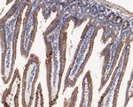 C1QBP Antibody in Immunohistochemistry (Paraffin) (IHC (P))