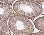 C1QBP Antibody in Immunohistochemistry (Paraffin) (IHC (P))