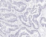 PIAS1 Antibody in Immunohistochemistry (Paraffin) (IHC (P))