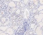 PIAS1 Antibody in Immunohistochemistry (Paraffin) (IHC (P))