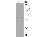 CD105 (Endoglin) Antibody in Western Blot (WB)