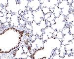 Nkx2.1 Antibody in Immunohistochemistry (Paraffin) (IHC (P))