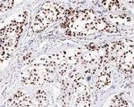 SR Antibody in Immunohistochemistry (Paraffin) (IHC (P))