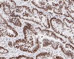 SR Antibody in Immunohistochemistry (Paraffin) (IHC (P))