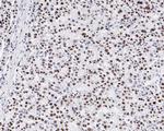 SR Antibody in Immunohistochemistry (Paraffin) (IHC (P))