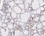 SR Antibody in Immunohistochemistry (Paraffin) (IHC (P))