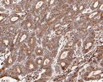 CHM Antibody in Immunohistochemistry (Paraffin) (IHC (P))