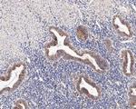 CHM Antibody in Immunohistochemistry (Paraffin) (IHC (P))