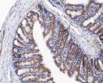 CHM Antibody in Immunohistochemistry (Paraffin) (IHC (P))