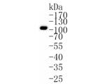 CHM Antibody in Western Blot (WB)