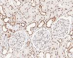 NOLA3 Antibody in Immunohistochemistry (Paraffin) (IHC (P))